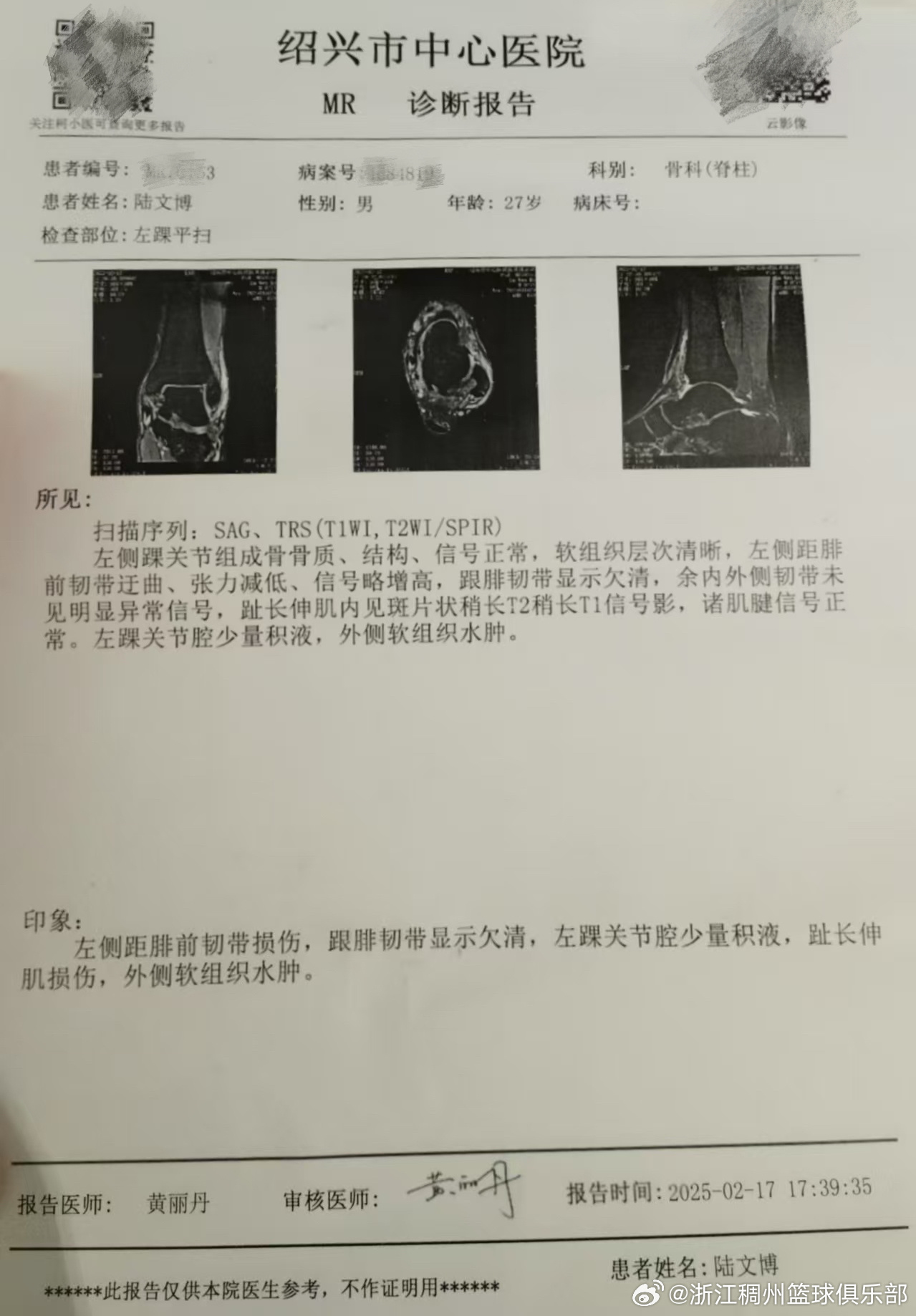 為了彌補近